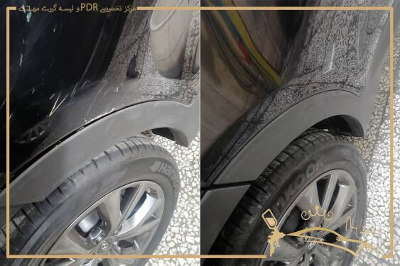 مقایسه قبل و بعد لیسه گیری در بهترین مرکز لیسه گیری غرب تهران